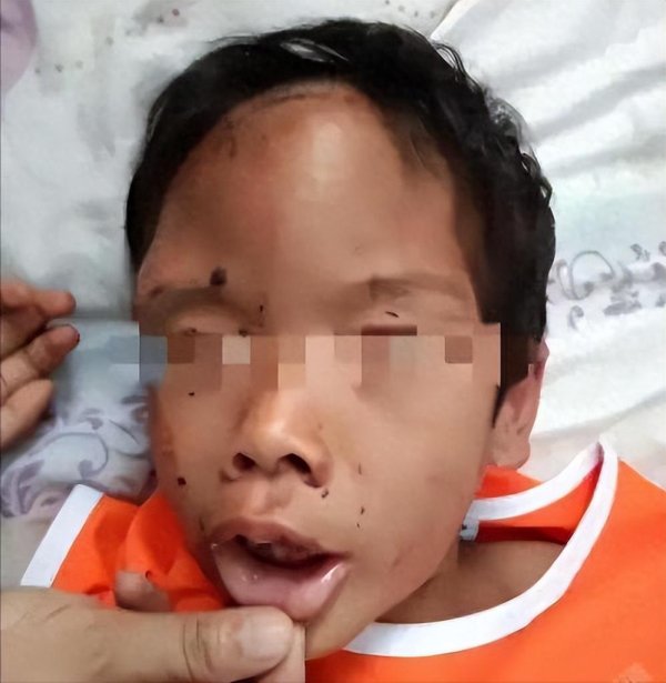 鑫优配 又是铅中毒，这次连婴儿都不放过！毒源发往全国各地，家长快自查
